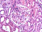  1057normal glom for MFD.jpg